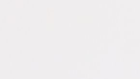 La acumulación de ácido úrico en el organismo es una condición que se conoce como hiperuricemia y se mide por niveles que superan los 7 mg/dl.