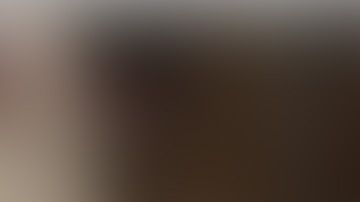 Tras ser evaluado por médicos, se determinó que Nico, requería ser intervenido de manera quirúrgica tras un choque con el portero de Tijuana