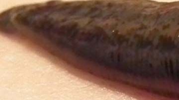 El caso se reportó en China.