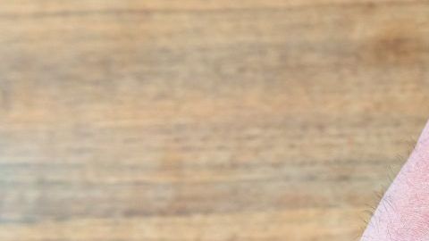 El paciente es diabético y por eso tuvo una complicación.