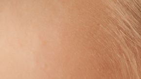 Limpiar tus oídos con hisopos puede ser  una mala idea.