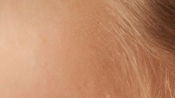 Limpiar tus oídos con hisopos puede ser  una mala idea.