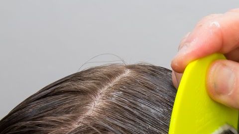 La menor se habría intoxicado.