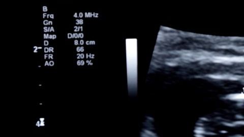 Una tomografía reveló la extraña condición.