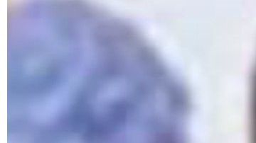 La esposa de Fernando Colina denunció negligencia médica en el tratamiento del cantante de “Sopa de caracol”.