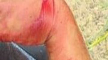 VIDEO Cartel del Noreste le destroza brazo a mujer polica en balacera en la frontera