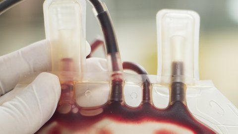 ¿Cuántos grupos sanguíneos dirías que existen?