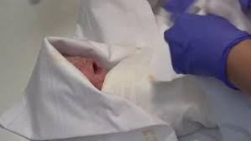 Bebé nace 117 días después de que su madre sea declarada muerta cerebralmente.