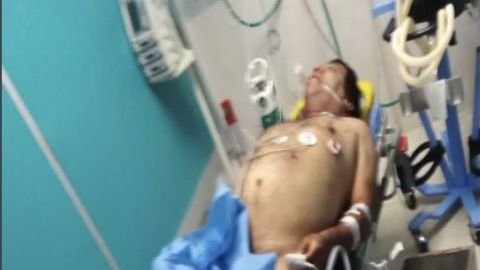 Sin piedad brazo armado del CJNG se abre paso le propina 8 balazos a familiar de El Pozoles