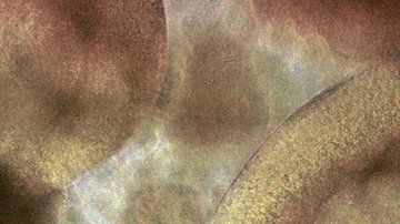 Muchas cosas se desconocen acerca de este tratamiento.