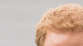 El Príncipe Harry y Ed Sheeran comparten una característica física que provoca el bullying en Reino Unido.