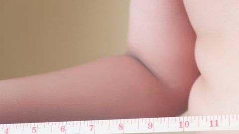 La obesidad global se triplicó desde 1975.