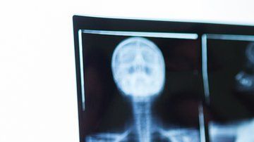 El de pecho es el cáncer más frecuente en las mujeres y afecta globalmente a 2,1 millones de mujeres por año, según la OMS.