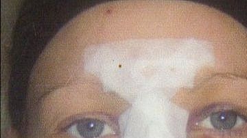 Catherine Roan quedó como si hubiera sufrido un "accidente automovilístico" después de una cirugía estética.