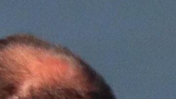 Se está considerando emplear dispositivos de alta tecnología utilizados en operaciones antiterroristas para poder identificar a los autores de las ofensas racistas.