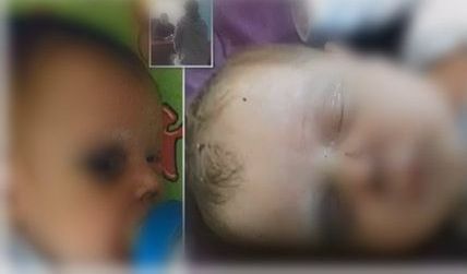 El pequeñito aún se encuentra delicado.