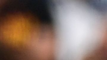 El partido tuvo que ser interrumpido para sacar al hombre de la cancha,