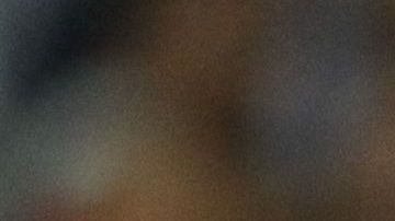 Hurtado sufrió ruptura del tendón de Aquiles en la pierna izquierda.