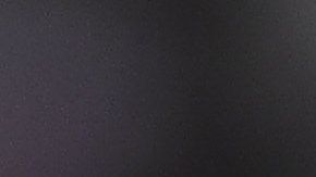 El jugador del América estará 6 semanas de baja.