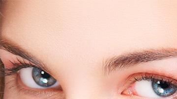 silhouette-lift-hilos-tensores-1539803760