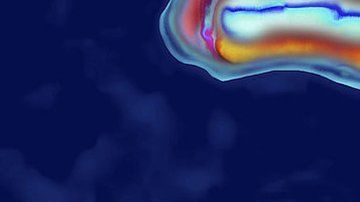 La peste está causada por la bacteria Yersinia pestis.