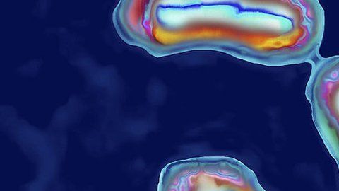 La peste está causada por la bacteria Yersinia pestis.