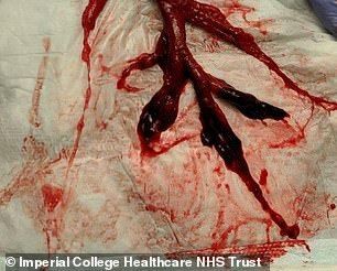 20856780-7672337-a-a-18_1573467493349