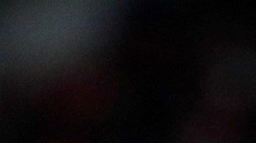 De ser operado Diego Costa podría estar hasta tres meses fuera de la competición.