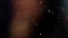 Los jugadores de la Serie A lucieron hoy una 'mancha' roja en el rostro.