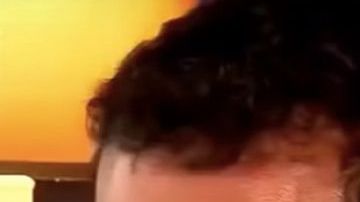 Mahud Villalaz, víctima de ataque con ácido.