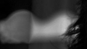 alergia-asfixia-Linus Schütz-Pixabay