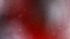 Patrick Mahomes jugará el lunes en México.