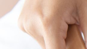 La joven deberá hacerse implantes si quiere recuperar su pelo.