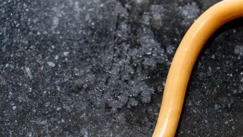 El parásito lo contrajo nadando en un lago en África.