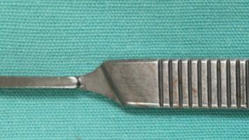 El fragmento de bala que lograron sacarle de la cabeza. Los doctores no pudieron remover algunas esquirlas.