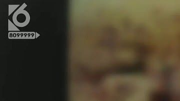 La bebé necesitará cirugías para reconstruirle el rostro.