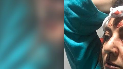 Agresión que sufrió Abril en enero pasado.