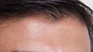 El esposo  trató de matarla a principio de año.