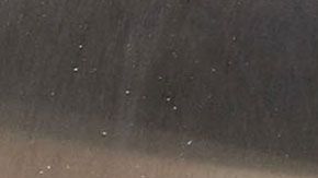 La mujer sufrió quemaduras en el cuello y hombro.