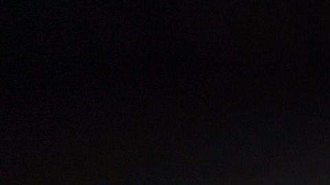 Calculos biliares-canva