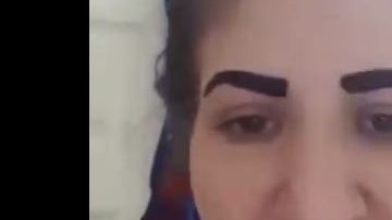 Cometió un tremendo error que arruinó su rostro.