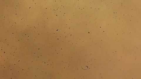 El carbón negro o el polvo pueden aumentar el derretimiento anual en los glaciares.