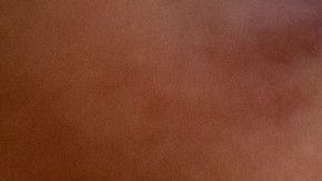 Para revertir los efectos de una sobredosis de opioides expertos recomiendan el  uso de Narcan.