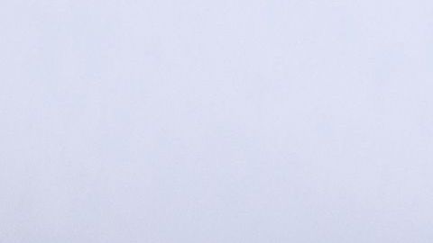 Doctor shows kidney.