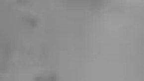 Le encontraron esto en el interior del ano.