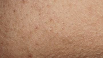 shutterstock_1038485245