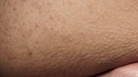 shutterstock_1038485245