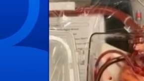 El proceso es conocido “Donación tras la Muerte Circulatoria".