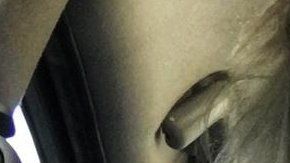 Kerry Van Der Merwe sufre de pecho hendido y quiere crear conciencia sobre la condición.