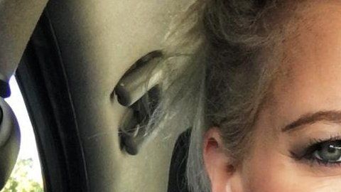 Kerry Van Der Merwe sufre de pecho hendido y quiere crear conciencia sobre la condición.